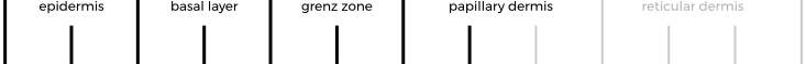 Peeling profundidad media