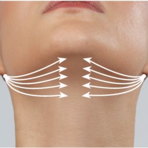 Areas EXCELLENCE VISAGE METHOD (3) ÁREA SUBMENTAL Y CUELLO-EV METHOD