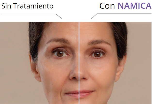 antes y despues namica aptos antes y despues namica aptos