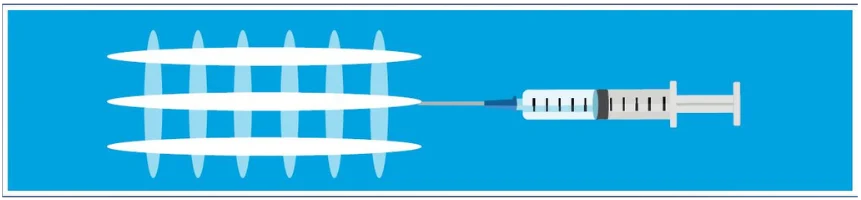 Técnica de rayas cruzadas Genefill