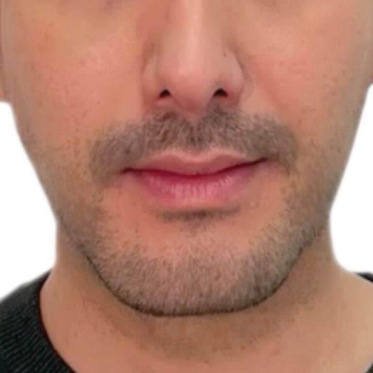 xr:d:DAFhGcbUqVE:9,j:45846826122,t:23042510