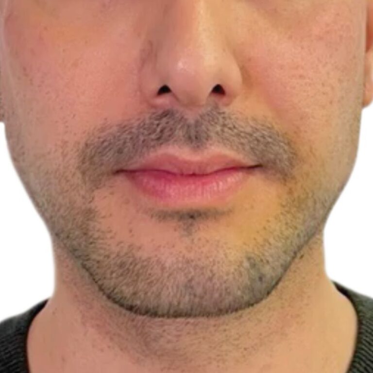 xr:d:DAFhGcbUqVE:10,j:45846977638,t:23042510