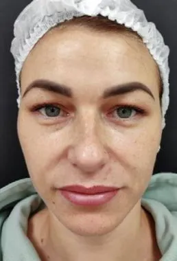 imgi_18_despues-cellbooster-lift