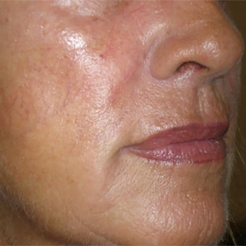 imgi_20_despues-del-colageno-karisma