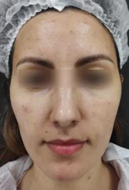 imgi_21_antes-cellbooster-glow