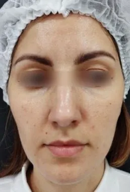 imgi_22_despues-cellbooster-glow