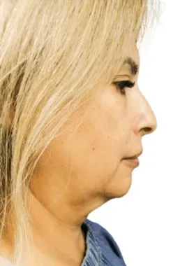 imgi_25_antes-cellbooster-shape