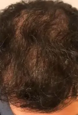 imgi_30_despues-cellbooster-hair