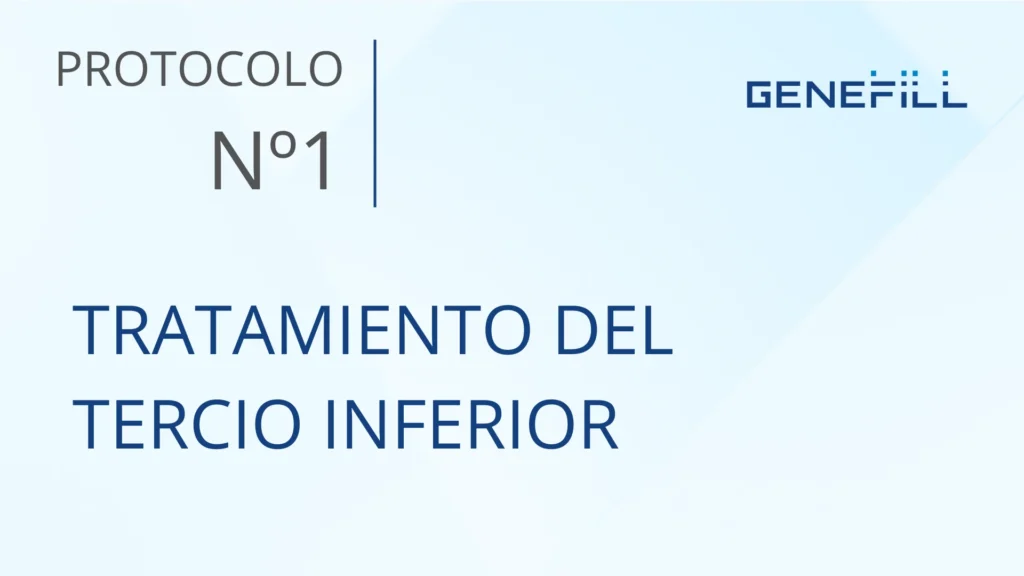 Tratamiento-tercio-inferior