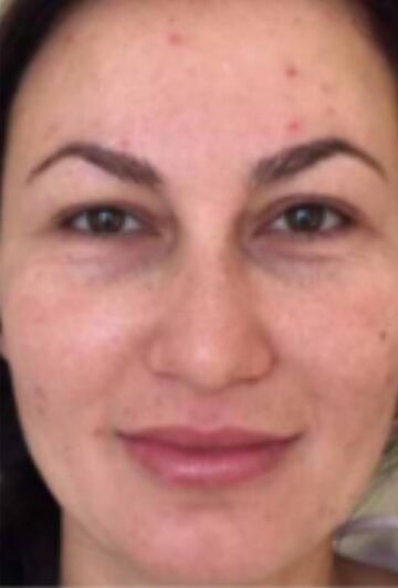 xr:d:DAFrr3OKmR4:2,j:1562023047975099163,t:23081607