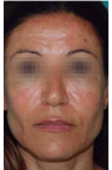 xr:d:DAFrr3OKmR4:2,j:1562023047975099163,t:23081607