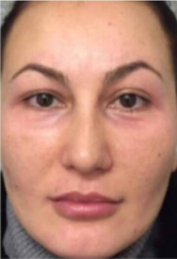 xr:d:DAFrr3OKmR4:2,j:1562023047975099163,t:23081607