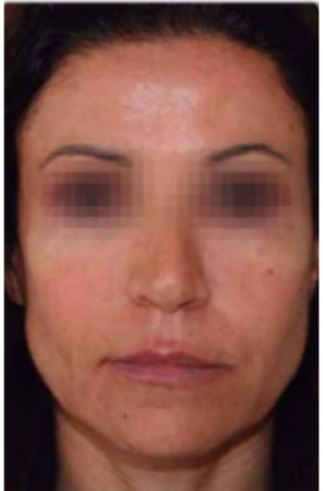 xr:d:DAFrr3OKmR4:2,j:1562023047975099163,t:23081607