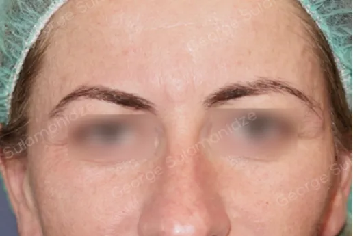 imgi_15_FOTO-ANTES-NE-METHOD