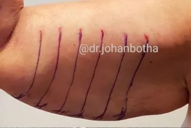 imgi_15_antes-BODY-EXCELLENCE-METHOD