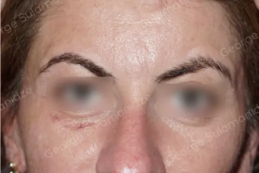 imgi_16_FOTO-DESPUES-NE-METHOD