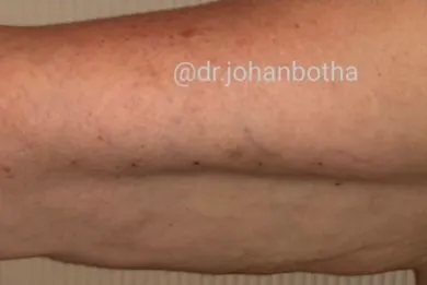 imgi_16_despues-BODY-EXCELLENCE-METHOD