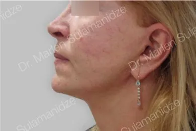 imgi_18_Despues-LLNM