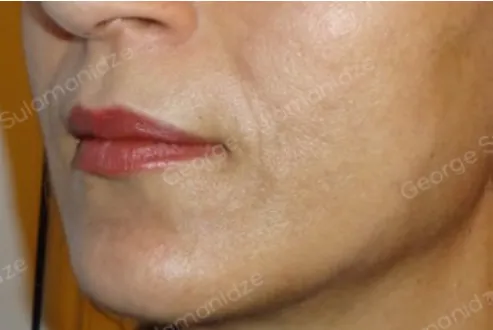 imgi_19_FOTO-DESPUES-NS-METHOD