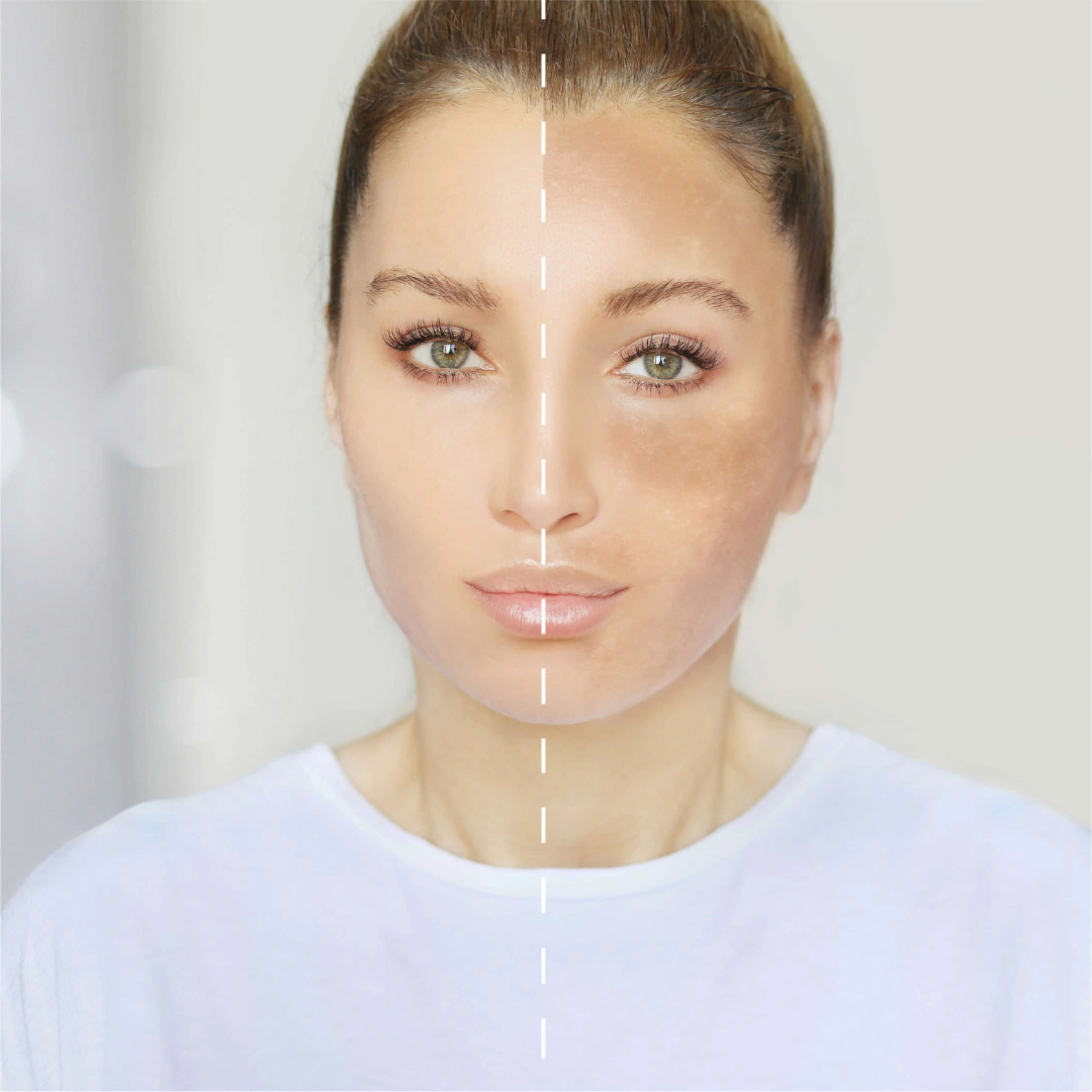 tratamiento de manchas en la piel