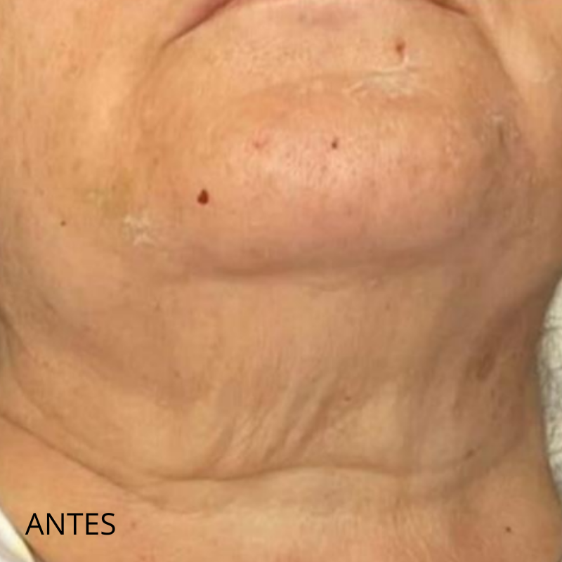 1 previsualización formulario