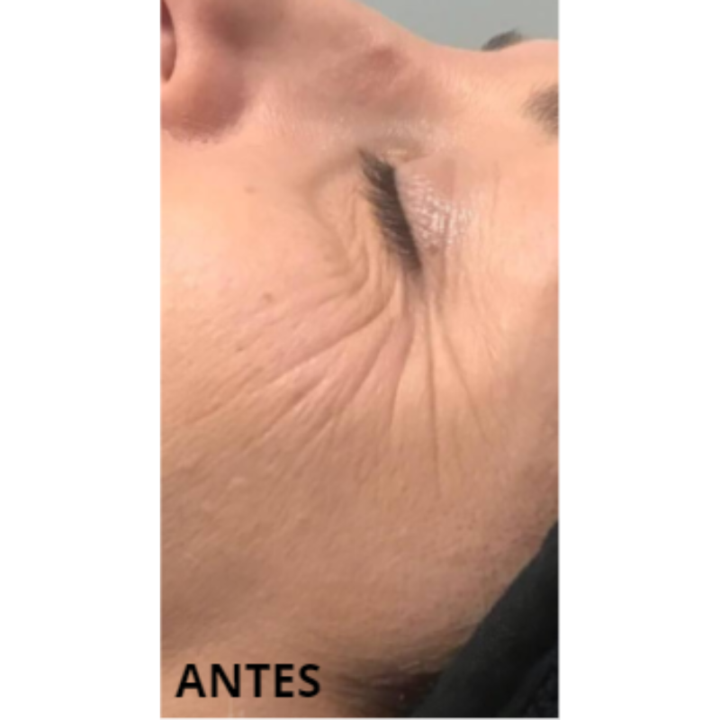 previsualización formulario