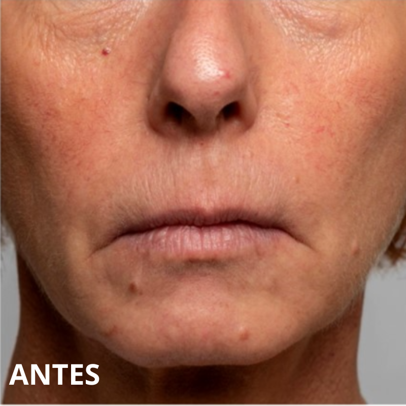 previsualización formulario